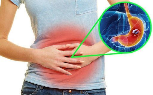Tốt cho hệ tiêu hóa, hỗ trợ giảm cân
