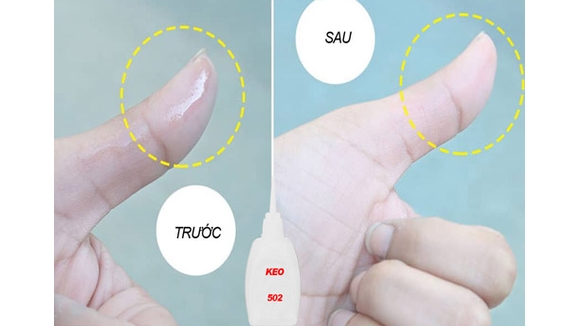 Mẹo tẩy keo 502 dính trên da nhanh chóng